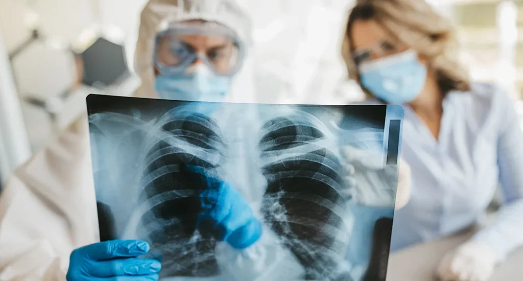 Lung Cleansing Spray MediLisk™